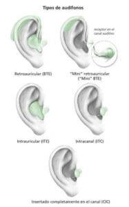 Tipos de Audífonos Baratos